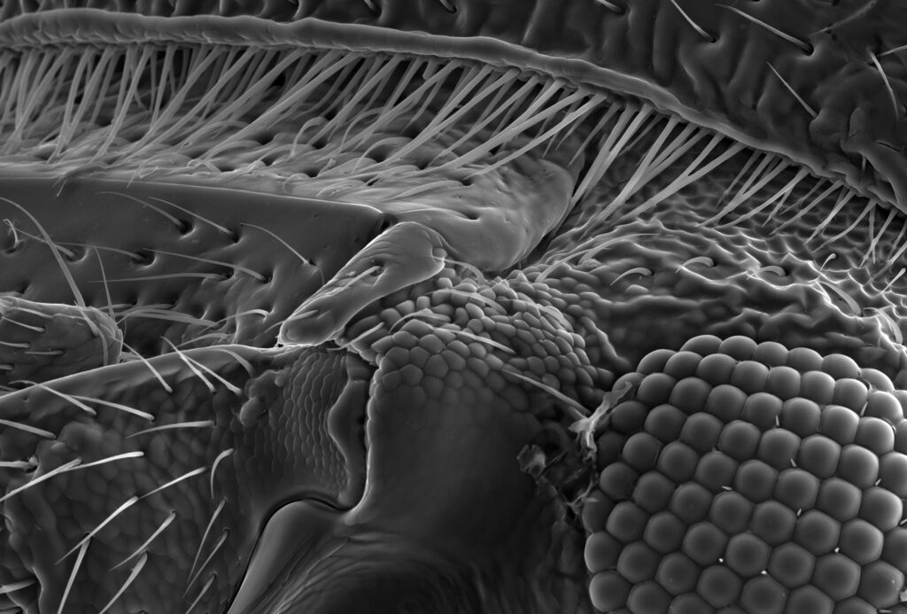 Botfly larvae developing under human skin with medical instruments nearby