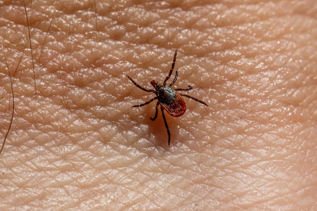 Side-by-side of different necrotic wounds with and without spider cause