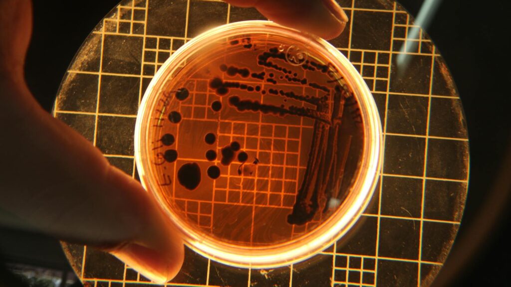 Close-up of bacterial colonies in a Petri dish under a microscope in a lab setting.