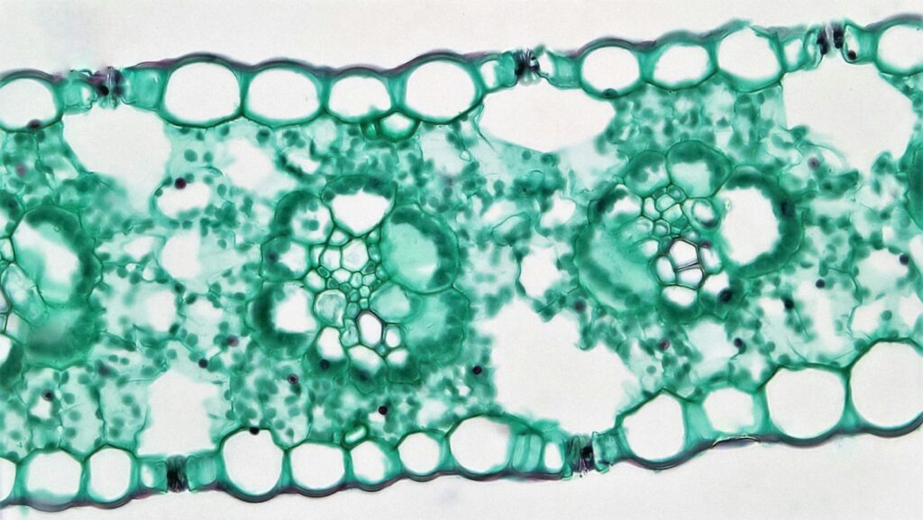 Microscopic view or diagram showing breakdown of larval tissues during histolysis