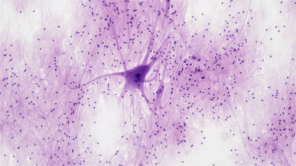 Close-up of a lacewing's head showing its complex neurological structures
