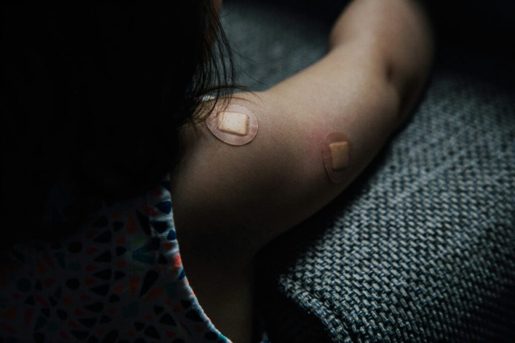 Medical alert graphic showing signs of anaphylaxis after a sting
