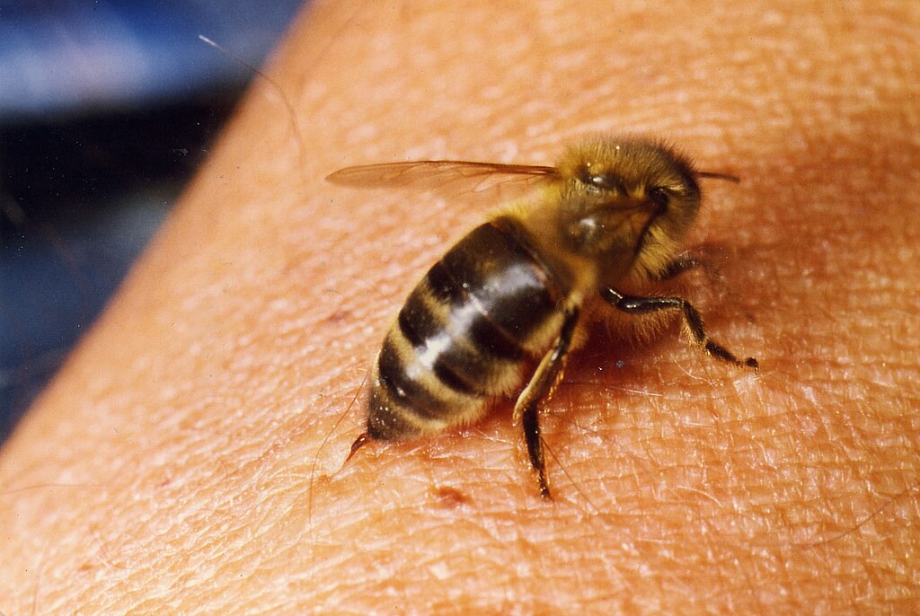 Bee sting
