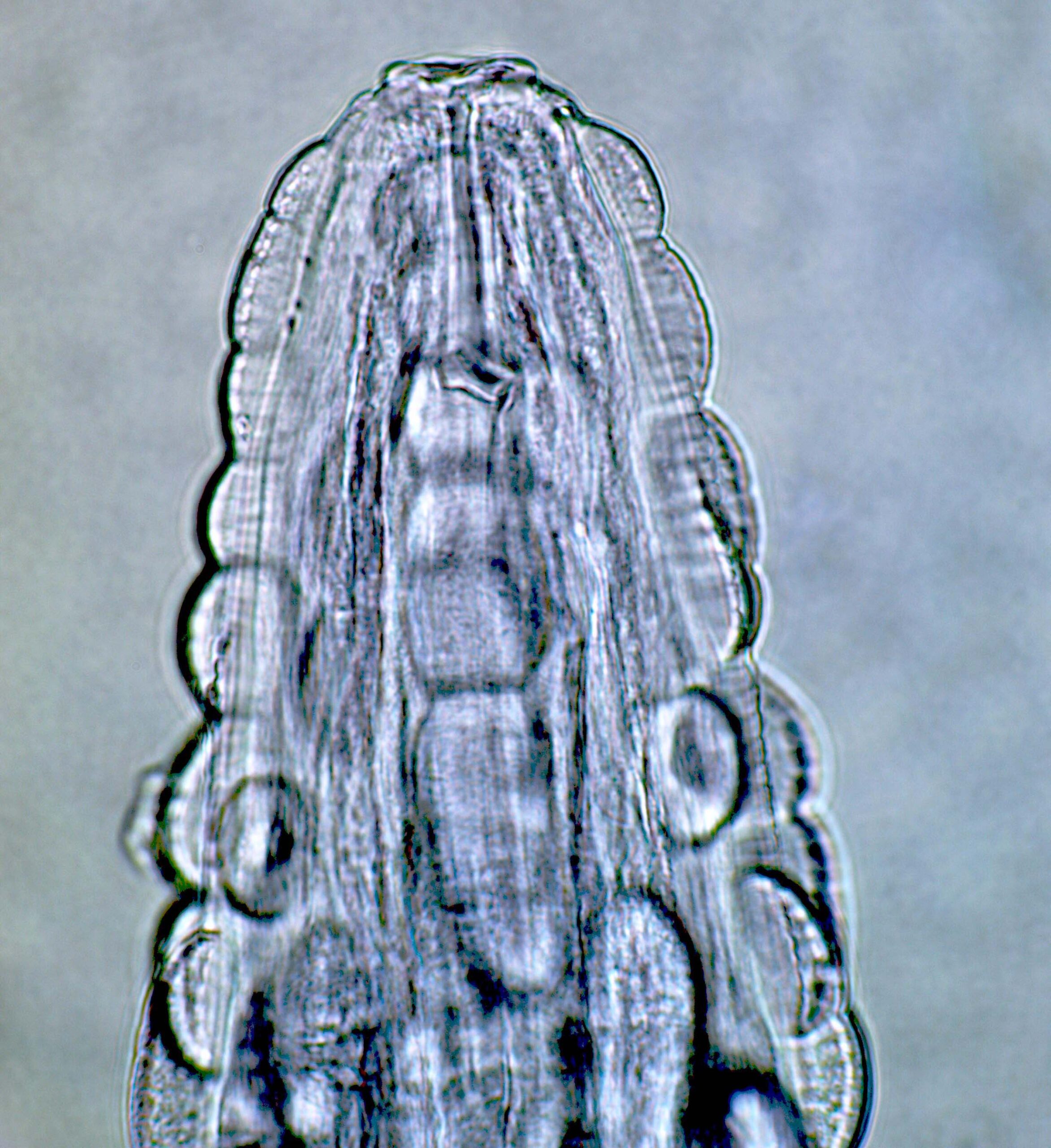 Nematodes: The Microscopic Worms Living in Your Pipes (image credits: wikimedia)
