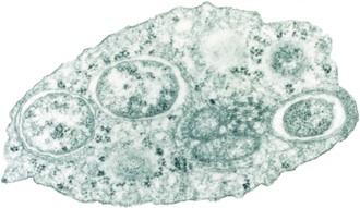 Wolbachia: The Bacterial Bodyguard (image credits: wikimedia)