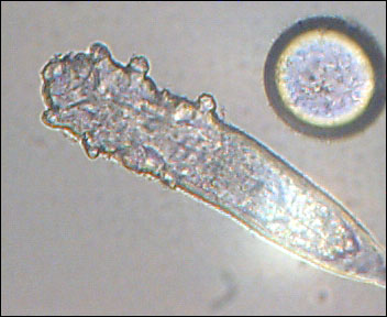 What Face Mites Actually Eat (image credits: wikimedia)