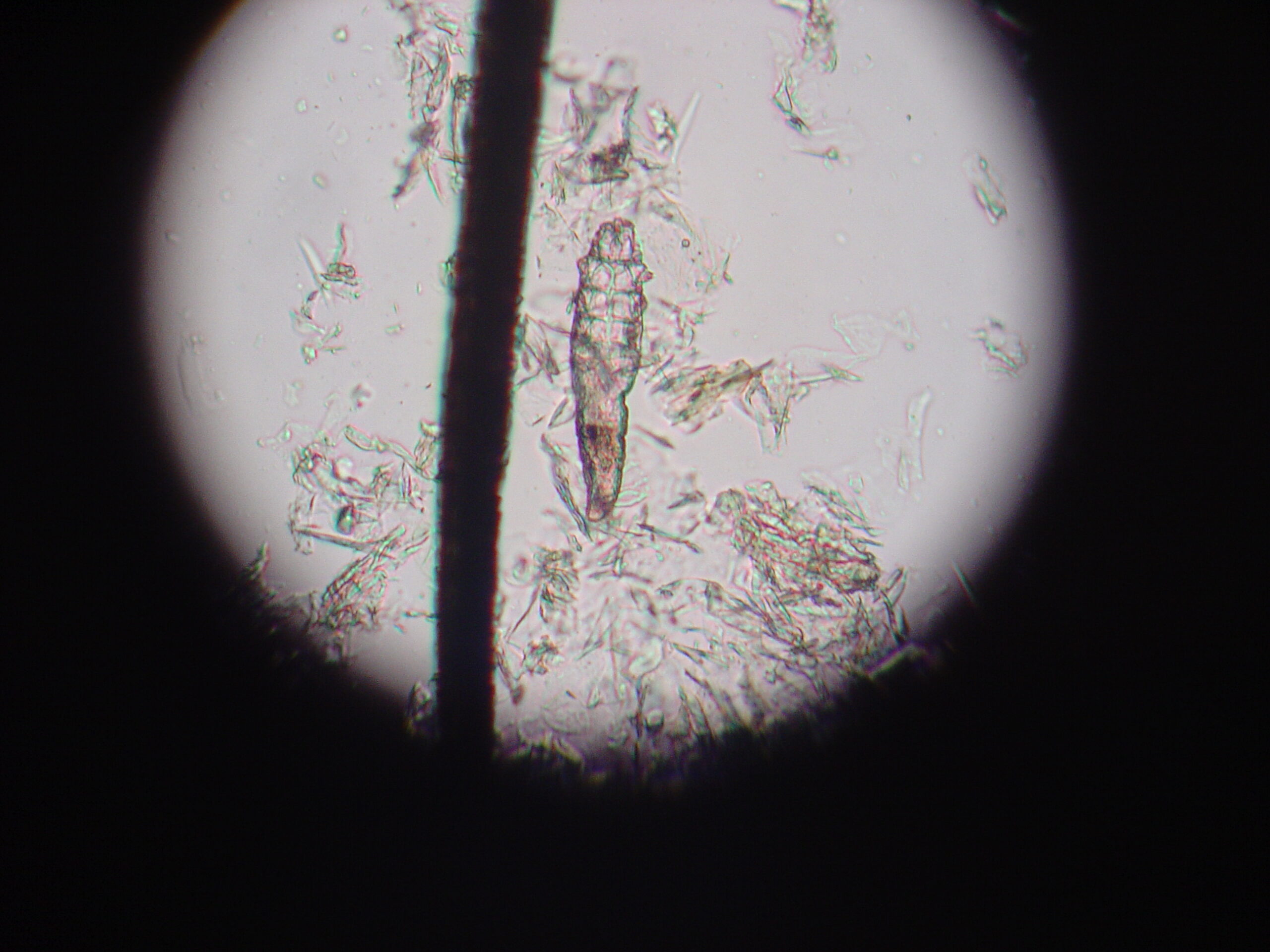 Why Some People Have More Mites Than Others (image credits: No machine-readable source provided. Own work assumed (based on copyright claims)., CC BY-SA 3.0, https://commons.wikimedia.org/w/index.php?curid=681722)