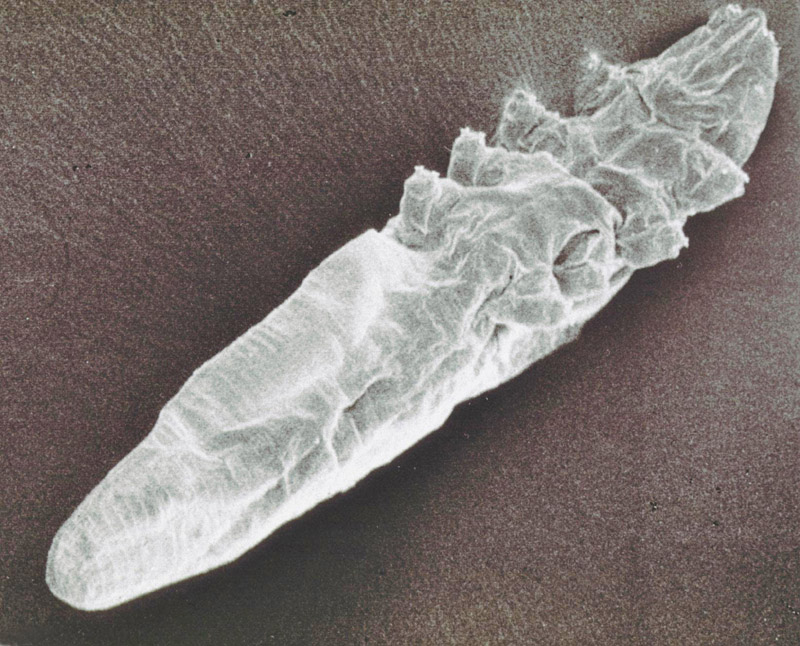 The Evolutionary Partnership Between Humans and Mites (image credits: By [[User:Alan R Walker (talk) 09:16, 28 January 2014 (UTC)]], CC BY-SA 3.0, https://commons.wikimedia.org/w/index.php?curid=27934398)