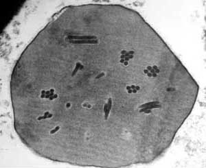 Baculoviruses: Nature's Biological Warfare Agents (image credits: wikimedia)
