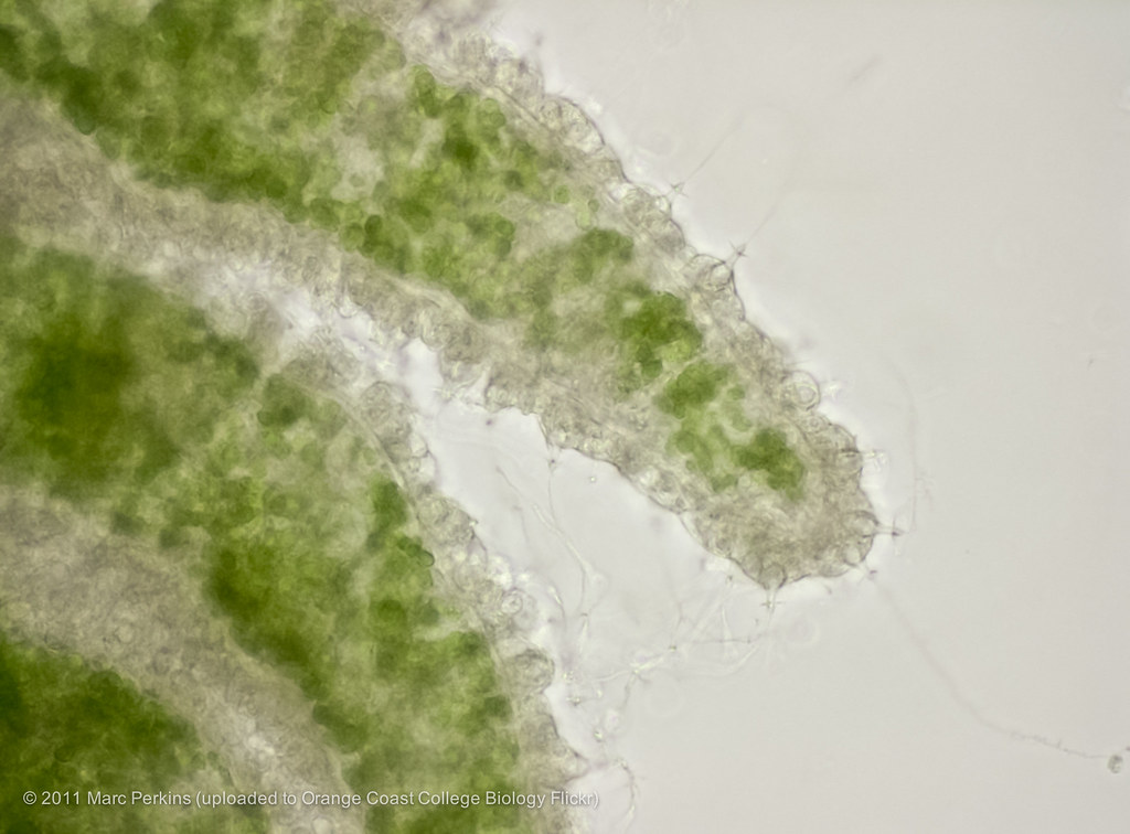 Hydra tentacles with nematocysts