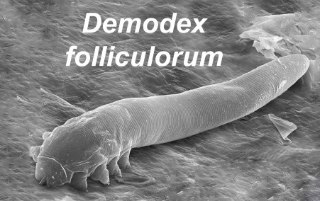 Demodex folliculorum