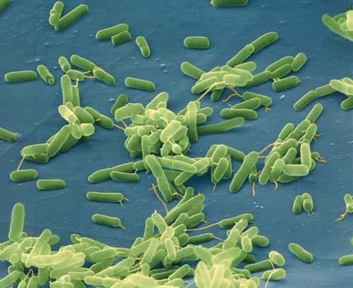 A micro image of Vibrio vulnificus