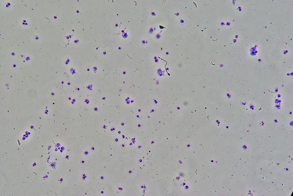 Toxoplasma gondii