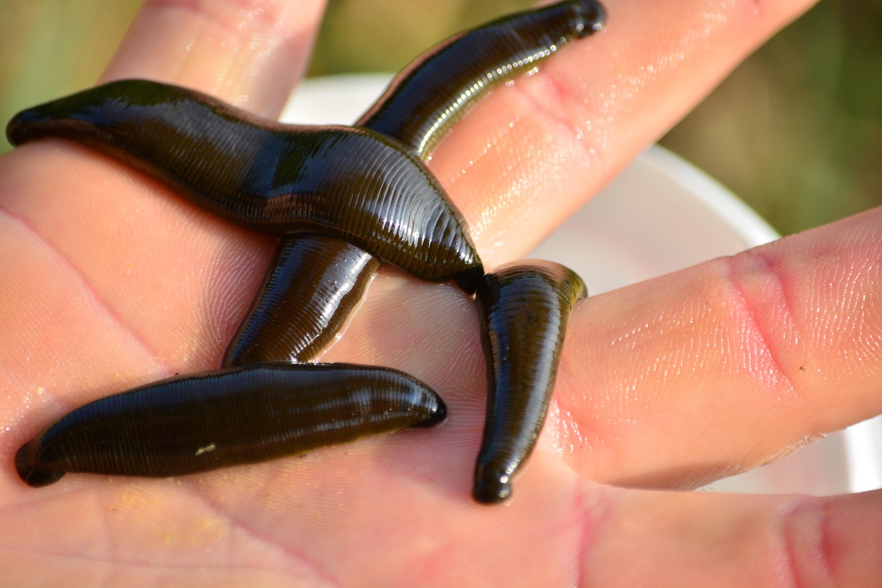 Leeches: The Slimy Surgeons of Antiquity (image credits: pixabay)