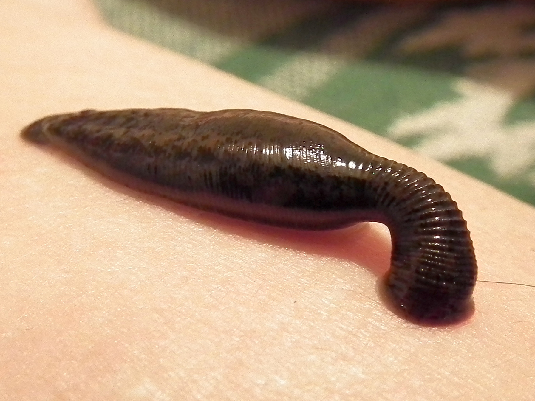 The Rise and Fall of Leech Therapy (image credits: wikimedia)