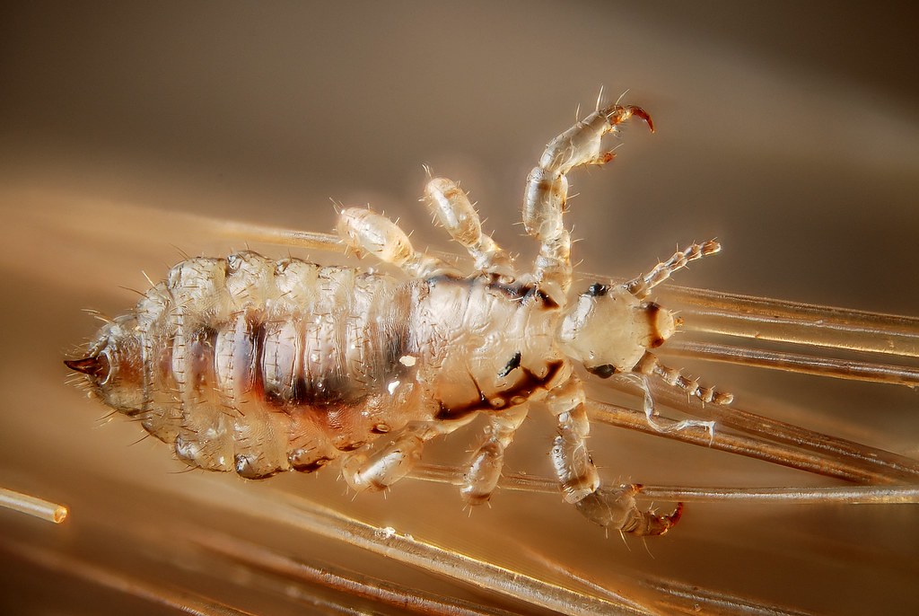 Lice: The Unwanted Healers (image credits: flickr)