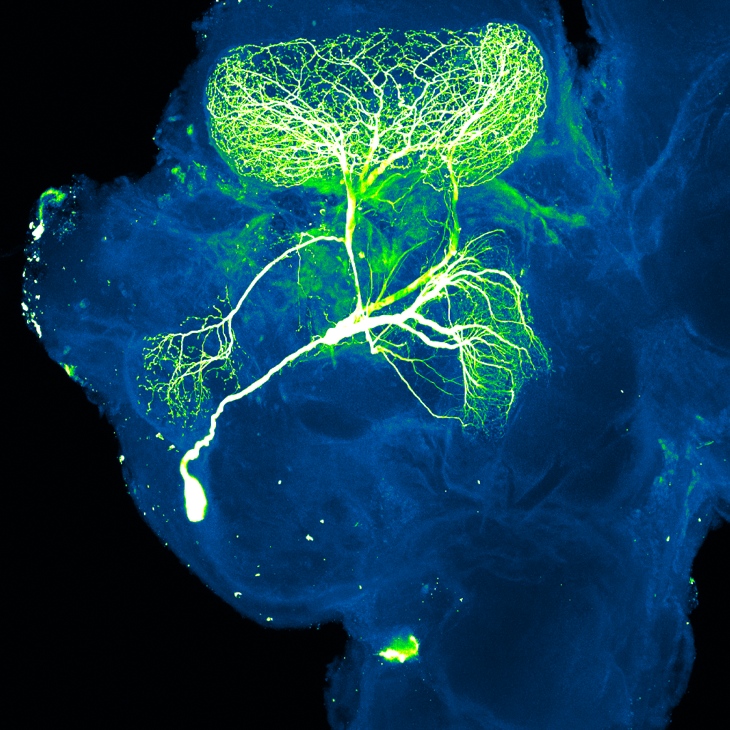 The Neuroscience Behind Tiny Brains (image credits: By NICHD, CC BY 2.0, https://commons.wikimedia.org/w/index.php?curid=102425113)