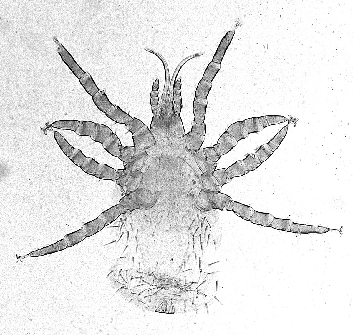 Bird Mites: The Seasonal Surprises (image credits: wikimedia)