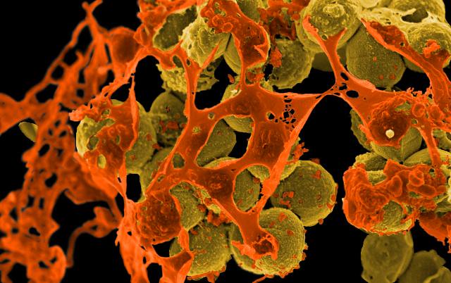 Air-Purifying Partnerships: Plants and Microbes Working Together (image credits: flickr)