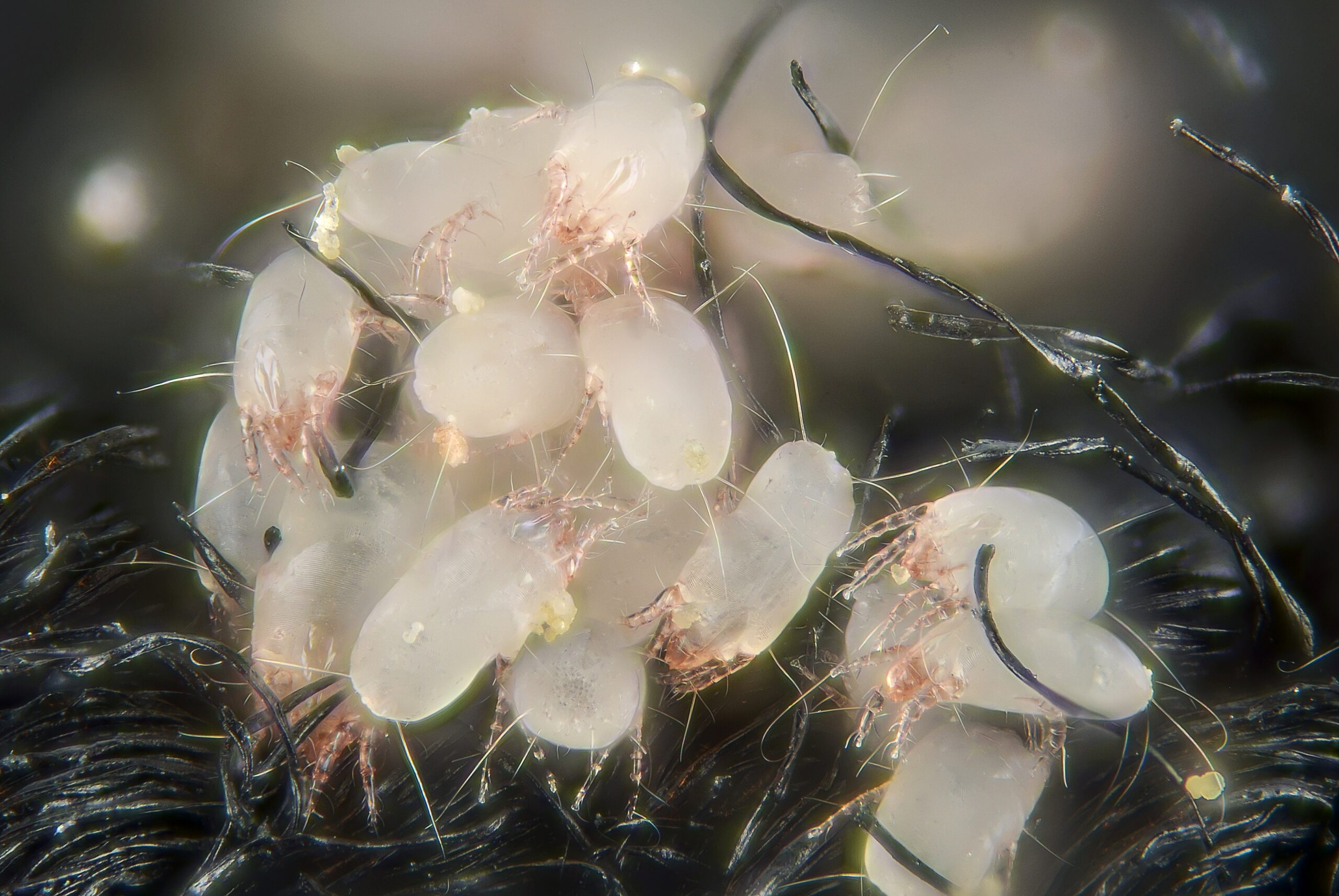 Dust Mites: The Bedroom Banquet Specialists (image credits: House dust mites

Uploaded by Jacopo Werther, CC BY-SA 2.0, https://commons.wikimedia.org/w/index.php?curid=24610942)