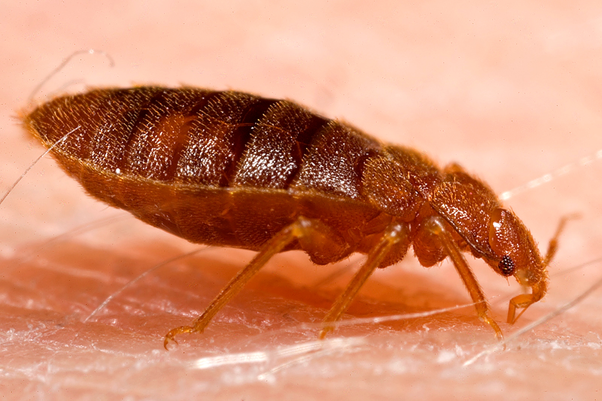 Why Traditional Treatments Often Miss Baseboard Infestations (image credits: This media comes from the Centers for Disease Control and Prevention's Public Health Image Library (PHIL), with identification number #9820.


Note: Not all PHIL images are public domain; be sure to check copyright status and credit authors and content providers.



العربية | Deutsch | English | македонски | slovenščina | +/−, Public domain, https://commons.wikimedia.org/w/index.php?curid=2119251)