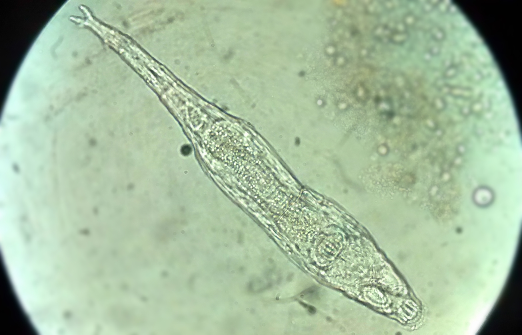 Rotifers: The Wheel Animals (image credits: wikimedia)