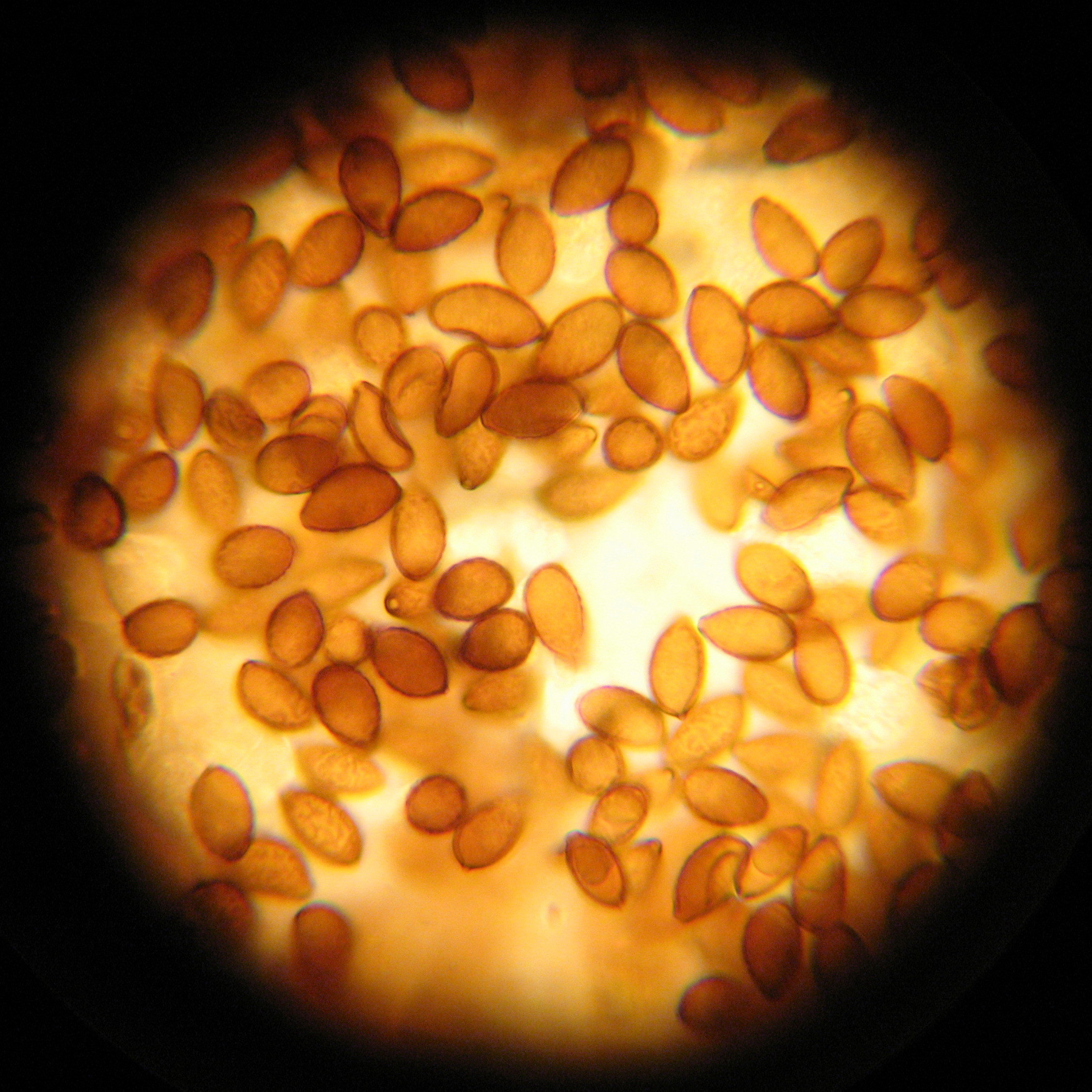 Fungal Spores: The Microscopic Travelers (image credits: wikimedia)