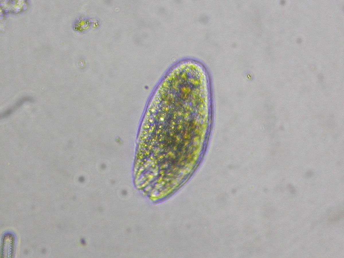 Protozoa: The Single-Celled Hunters (image credits: wikimedia)