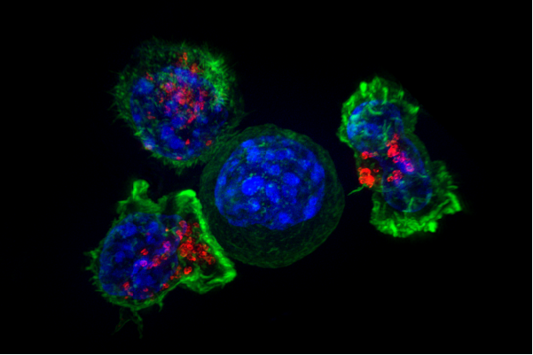 Illuminating the Invisible Enemy (image credits: By The National Institutes of Health, Public domain, https://commons.wikimedia.org/w/index.php?curid=49182097)