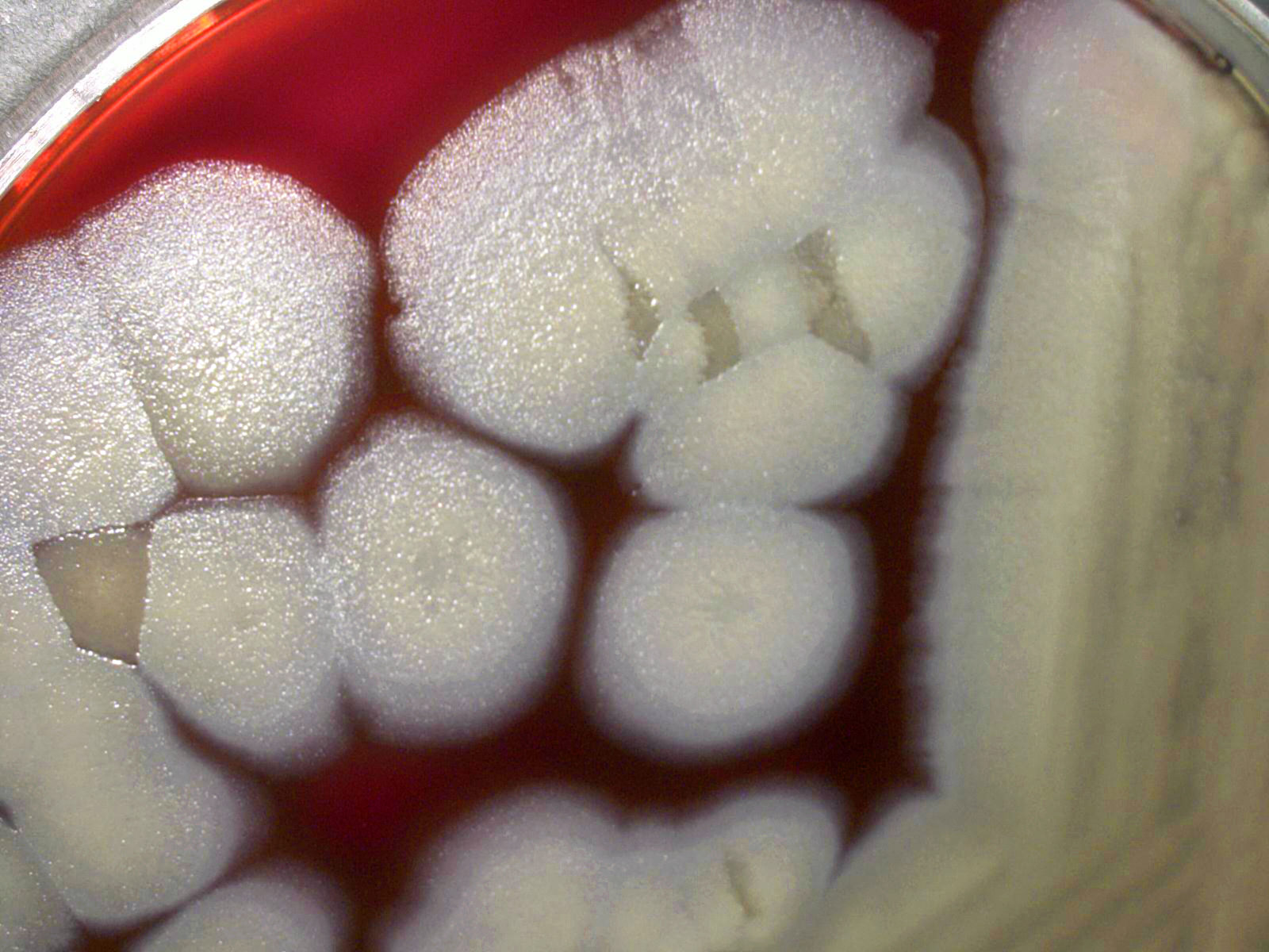 The Microscopic Heroes: Beneficial Bacteria (image credits: This media comes from the Centers for Disease Control and Prevention's Public Health Image Library (PHIL), with identification number #17111.


Note: Not all PHIL images are public domain; be sure to check copyright status and credit authors and content providers.



العربية | Deutsch | English | македонски | slovenščina | +/−, Public domain, https://commons.wikimedia.org/w/index.php?curid=76837075)