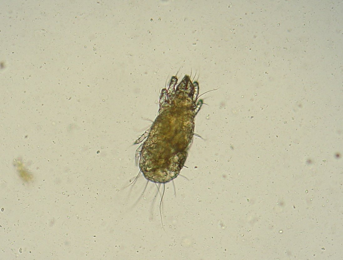 Flour Mites: The Microscopic Multitudes (image credits: wikimedia)