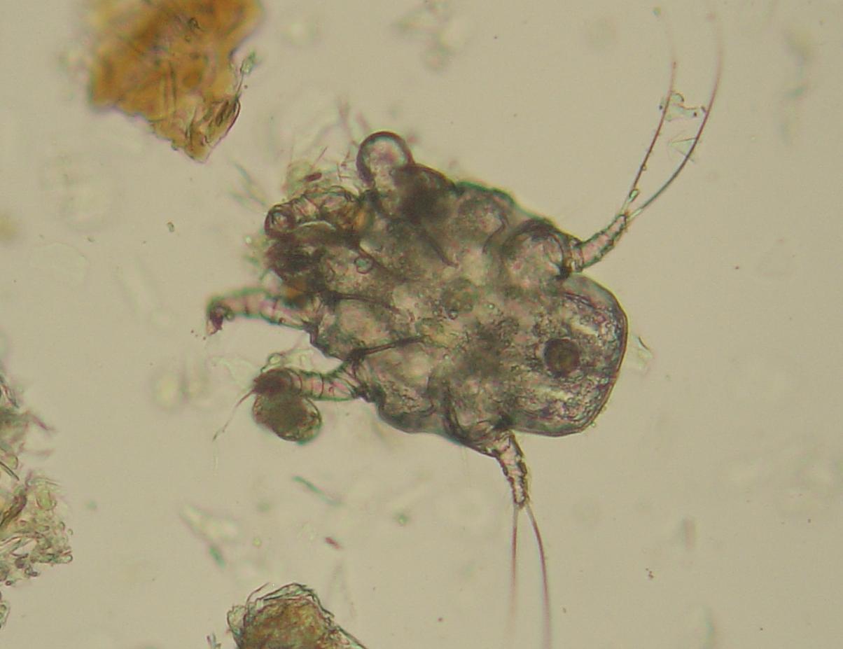 The Microscopic Mite Universe (image credits: wikimedia)